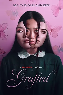 移植封面图